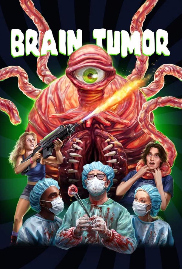 Опухоль мозга